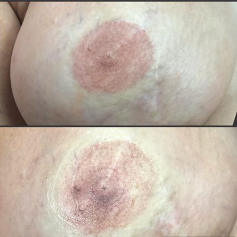 nipple